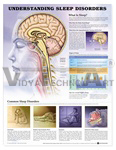 Understanding Sleep Disorders Anatomical Chart